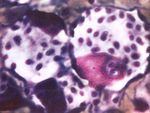 Původce toxoplasmózy - prvok Toxoplasma gondii v makrofagických buňkách experimentální myši. Roztěrový preparát. Giemsa. Zvětšení 4580x.